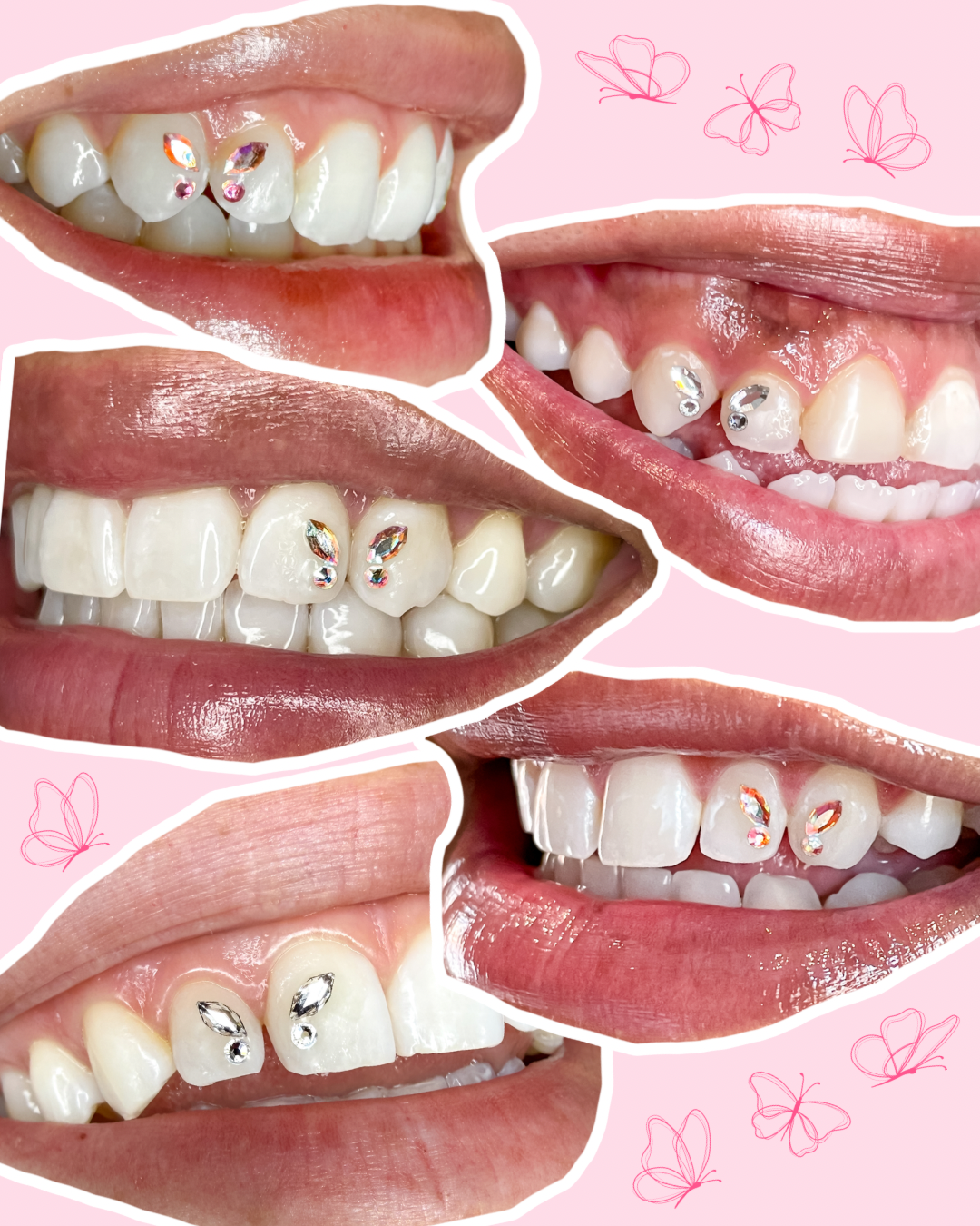 How to Make Butterfly Tooth Gems Last Longer