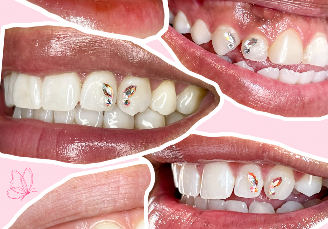 How to Make Butterfly Tooth Gems Last Longer
