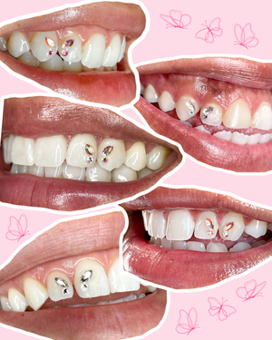 How to Make Butterfly Tooth Gems Last Longer